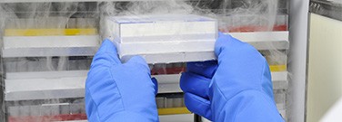 Nota inteligente: reducción del uso de energía de ULT Nota inteligente: reducción del uso de energía de ULT