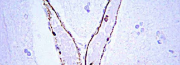 Anticuerpos primarios para Western Blot